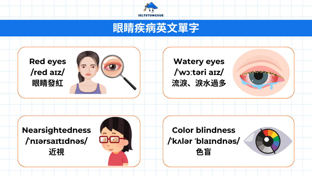 眼睛疾病英文單字